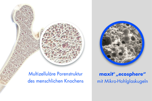  Die Natur vermeidet jede Form der Überdimensionierung. Das zeigt sich beim Aufbau menschlicher Knochen, die aus idealen, multizellulären Porenstrukturen bestehen. Ecosphere orientiert sich an diesem Beispiel  